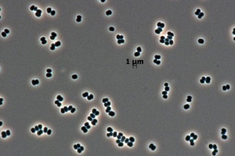 &laquo;Зомби-бактерия&raquo; из&nbsp;чистых комнат&nbsp;NASA&nbsp;могла пережить полёт к Марсу